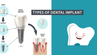 Types Of Dental Implants Available